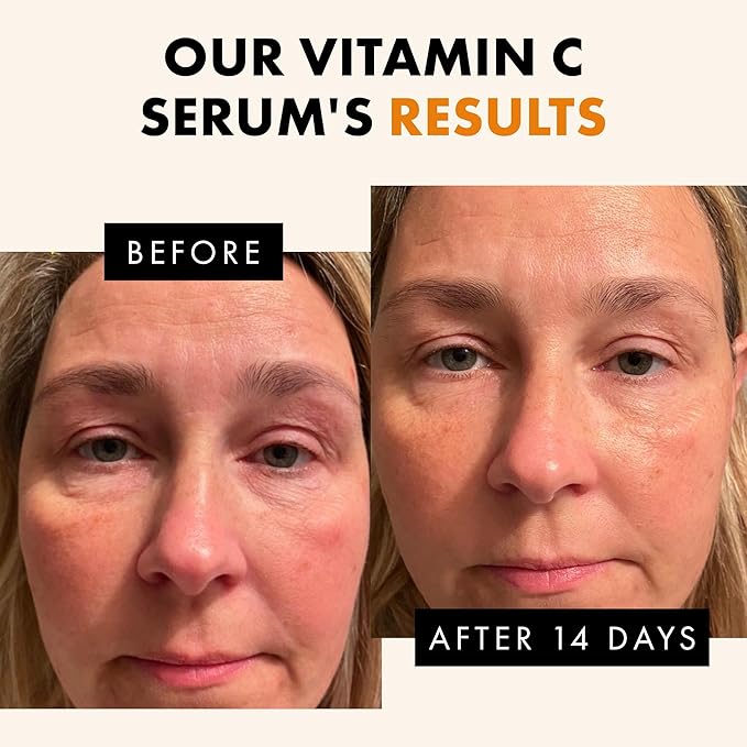 Vitamin C Face Serum - Skin Care for Dark Spots, Vitamin C Serum with Hyaluronic Acid, Ferulic Acid, & Vit E - Anti Aging and Skin Brightening, Pure Vit C Facial Care 30 ml