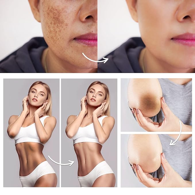 FAMIROSA Intimate Area Dark Spot Corrector-Underarm
