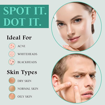 Advanced Invisible Pimple Patches For Face (36 Pack) - Hydrocolloid Patch with Tea Tree Oil - Vegan Friendly Hydrocolloid Acne Patches For Face and Skin - Pimple Patch Stickers - Acne Patch (12mm)