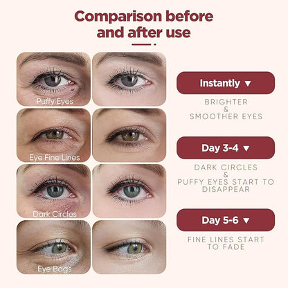 Under Eye Patches (20 Pairs), pink Hyaluronic Acid Eye Patches For Puffy Eyes, Dark Circles, Puffiness, Refresh,Revitalizing, Wrinkles, Anti Aging & Face Moisturizer For Women and Men.