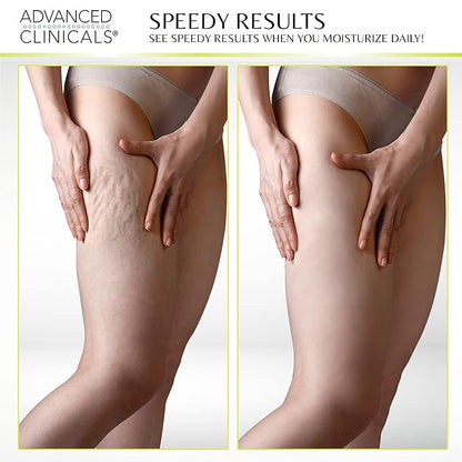 Advanced Clinicals Green Coffee Bean Thermo Firming