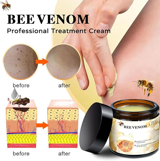 Bee Venom Cream,New Bee Venom Repair