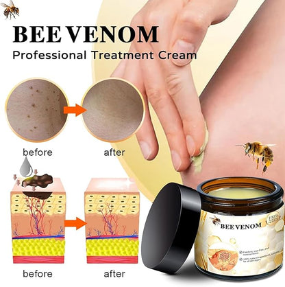 Bee Venom Cream,New Bee Venom Repair