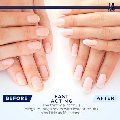 Blue Cross Cuticle Remover Liquid Gel, Cuticle Softener for Nails, Hydrating, Moisturizing, Professional Nail Care for Brittle Hang Nails, Dry Cuticles, Made in USA, 8oz, Eucalyptus/Tea Tree