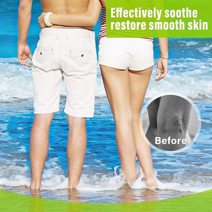 MOSKILA Varicose Veins Treatment for Legs,