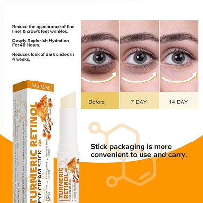 2 PCS Turmeric Retinol Eye Stick,Eye Balm Stick Hydrating for Dark Circle,Wrinkles,Visible Results in 3-4 Weeks,Anti Aging Under Eye,Retinol Eye Cream For Puffiness and Bags Reduces Fine Lines