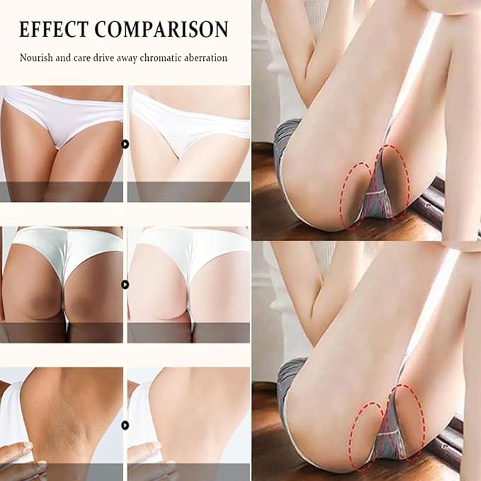 Intimate Area Cream for Dark Skin,