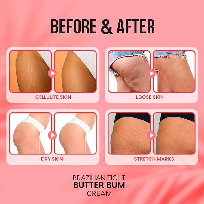Defying Cellulite Bum and Firm Cream,