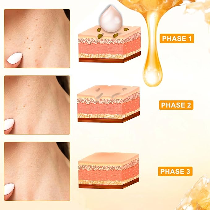 Bee Venom Cream, Professional Bee Venom