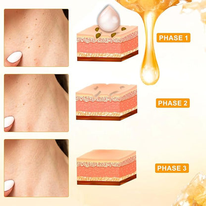 Bee Venom Cream, Professional Bee Venom