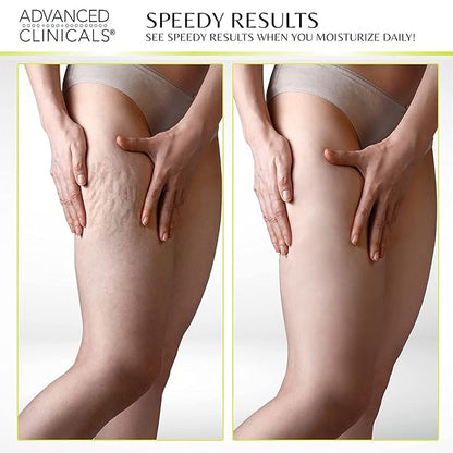 Advanced Clinicals Collagen Firming Cream + 16oz