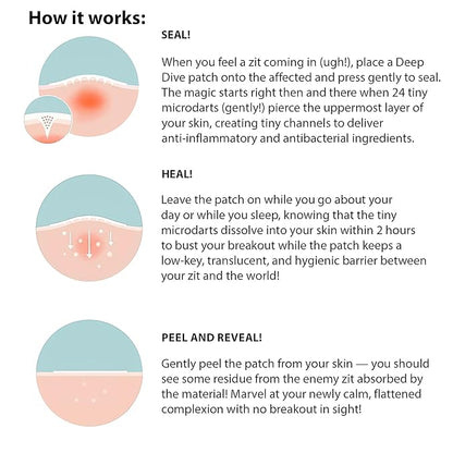Frilliance Microdart Hydrocolloid Acne Pimple Patches for Zits and Blemishes (4 count) Spot Treatment Stickers for Face & Skin, Vegan and Cruelty Free (Deep Dive Micro Darts)