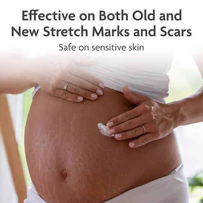 TriLASTIN-SR Intensive Stretch Mark Cream (5.5 Moisturizing