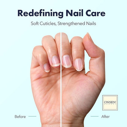 Onsen Secret Nail & Cuticle Repair Oil (10ml) - Dry Oil Formula - Japanese Tsubaki, Tea Tree & Jojoba - Strengthens Nails, Repairs Cuticles, Hydrates Skin & Hair - Natural & Vegan