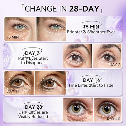 LANBENA Retinol Under Eye Patches for Dark Circles and Puffy Eyes, Cooling Eye Masks for Eye Bags, Fine Lines & Wrinkles Reduce, Anti-Aging, Hydra-Gel Collagen-30 Pairs