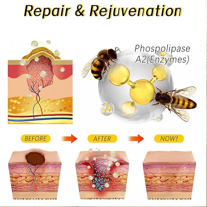 Bee Venom Cream for Removing and