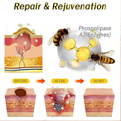 Bee Venom Cream for Removing and