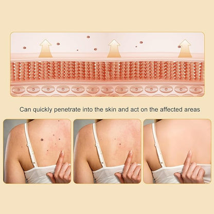 Bee Venom Cream for Removing and
