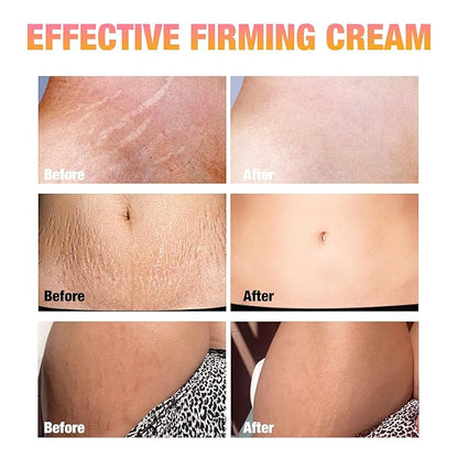 B Flat Belly Firming Cream -