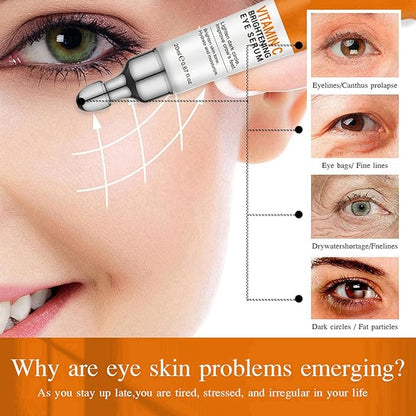 Vitamin C Eye Cream For Dark Circles, Under Eye Bag Cream Anti Aging Firming Creams For Women, Hydrating Eye Moisturizer Cream Reduce Fine Lines