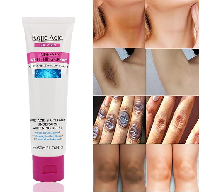 Kojic Acid Skin Whitening Cream