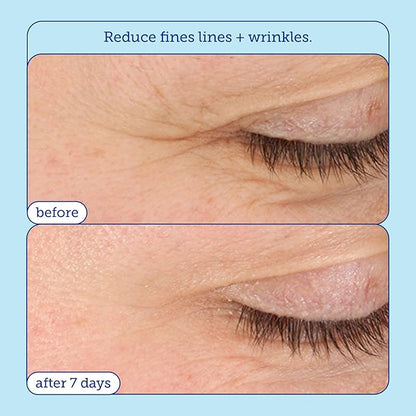 Skinfix Barrier+ Triple Lipid-Boost 360° Eye Cream: Targets Dark Circles, Puffiness, and Fine Lines Around Eyes and Lids, Clinically Proven to Brighten and Refresh Eyes, 0.5 oz