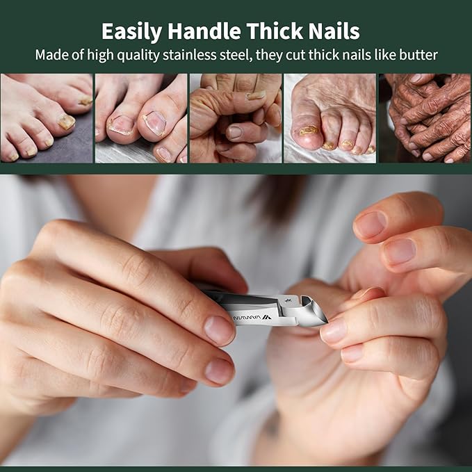 Ingrown toenail clippers, ultra sharp