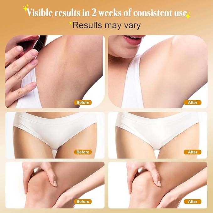 Skin Bleaching Cream for Body Intimate