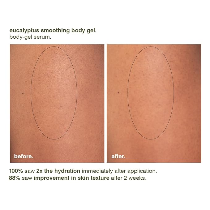 MALIN+GOETZ Women's Eucalyptus Smoothing Body Gel,