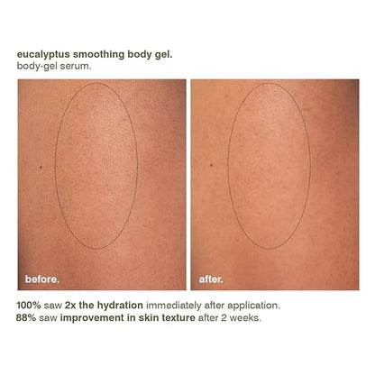 MALIN+GOETZ Women's Eucalyptus Smoothing Body Gel,