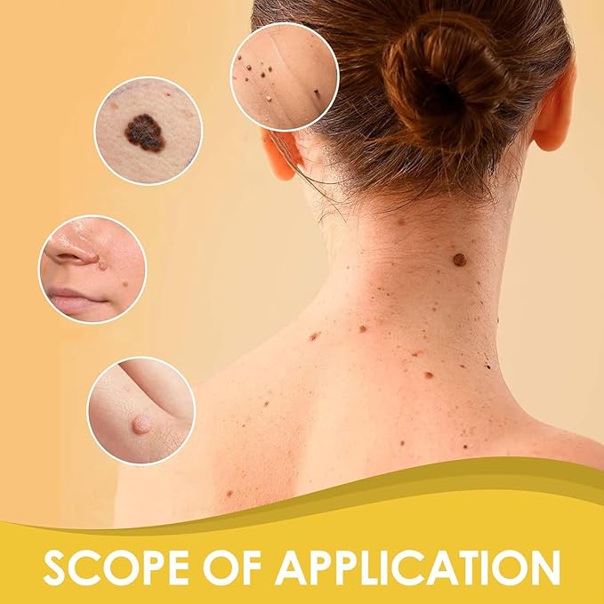 Bee Venom Cream for Removing and