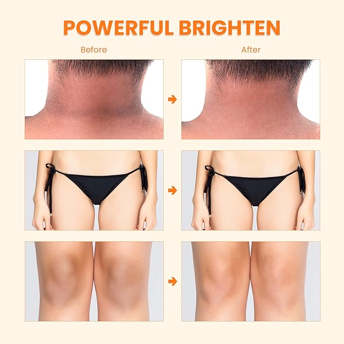 Dark Spot Cream, Brightening Cream, Underarm