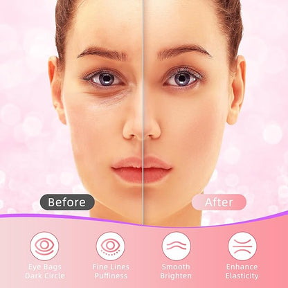 Under Eye Patches, 40 Pairs Eye Mask for Dark Circles, Puffy Eyes, Undereye Bags,Wrinkles,Eye Mask Patches with Rose, Eye Treatment Skin Care for Men & Women Gift