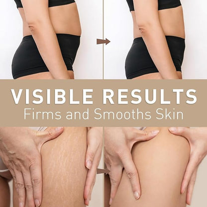 Belly Firming Cream for Tightening and