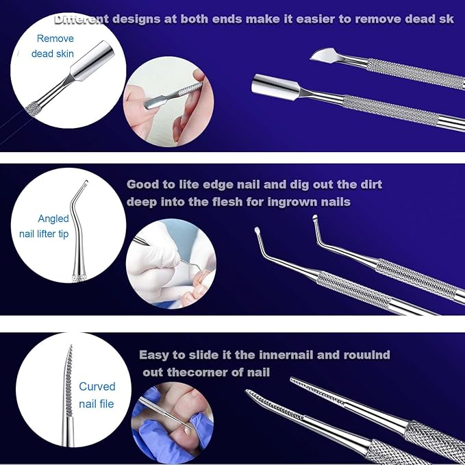 Ingrown Toenail File and Lifters