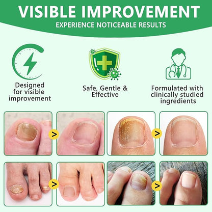 Ginger Nail Serum,Nail Growth Serum, Ginger Cuticle Care Oil for Strengthen Nails & Promote Nail Growth, Natural Plant Formula 2 Fl.oz