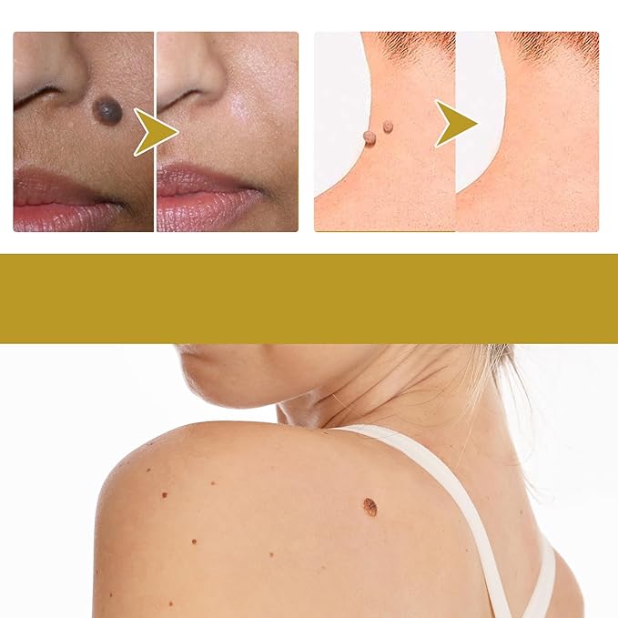 Bee Venom Professional Gel, Bee Venom