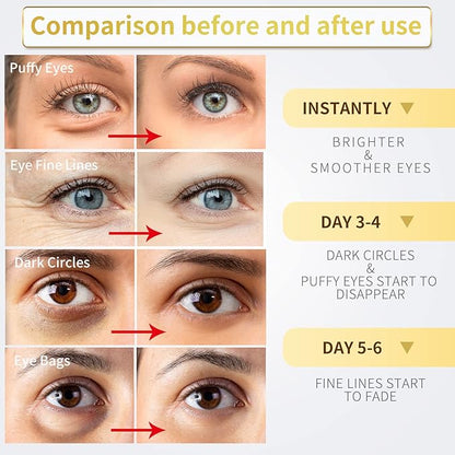 24K Gold Under Eye Patches - 60 Pack for Puffy Eyes, Dark Circles, Bags & Wrinkles with Collagen & Hyaluronic Acid