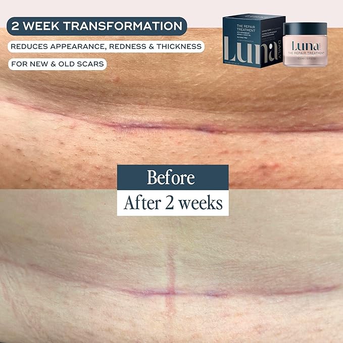 The Repair Treatment 50ml|Natural Scar Gel,