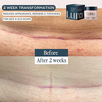 The Repair Treatment 50ml|Natural Scar Gel,