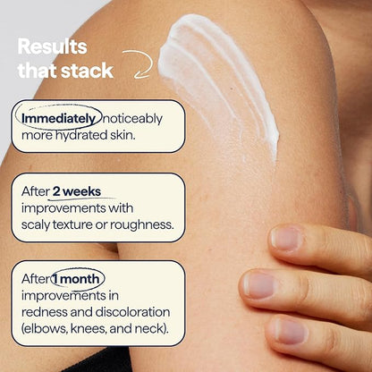 Remedy for Body Bumps – Treatment for Keratosis Pilaris (KP) and Textured, Crepey Skin with Urea, Lactic Acid, and Retinol -– Smoothing Body Moisturizer Lotion – By Dermatologist Dr. Shah
