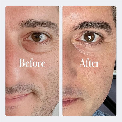 Geologie Anti-Aging Eye Cream | Treats Visible Signs of Aging | Reduce Fine Lines & Wrinkles | Retinol, Caffeine, Peptides, Niacinamide & Hyaluronic Acid | Effective Formula For Men & Women