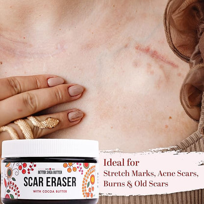 Better Shea Butter Scar Eraser Balm