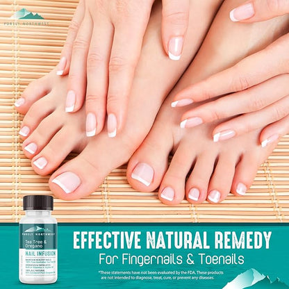 Extra Strength-Toenail Solution-100% All Natural-Tea Tree & Oregano-Effective for Thick, Discolored & Cracked Nails-Softens Dry Cracked Nails & Cuticles-by Purely Northwest 1oz