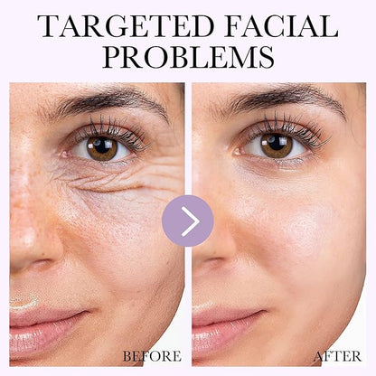 30pcs Under Eye Patches for Puffy Eyes and Dark Circles+6PCS Collagen Face Mask Overnight Bio-Collagen Real Deep Mask+Lip Mask & Lip Scrubber Exfoliator Lip Sleeping Mask Overnight