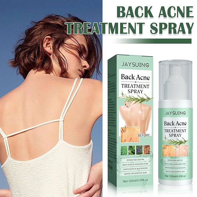 Back Acne Treatment Spray, Body Acne