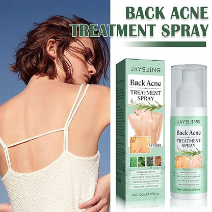 Back Acne Treatment Spray, Body Acne