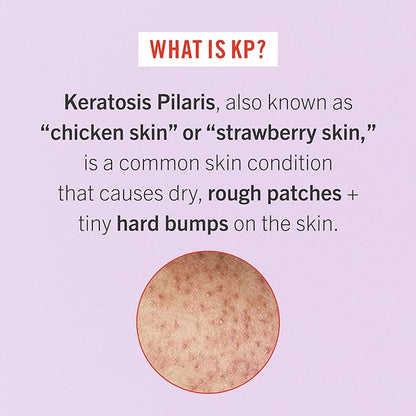First Aid Beauty Bye Bye Bumps
