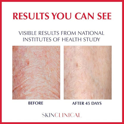 Extreme Healing, Non-Sticky, Fast-Absorbing Lotion For