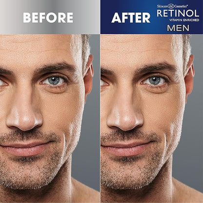 Retinol Men’s Eye Cream – The Original Retinol Eye Treatment For Men – Targets Under-Eye Area to Reduce Puffiness & Dark Circles, Boost Hydration & Drastically Minimize the Visible Signs Of Aging